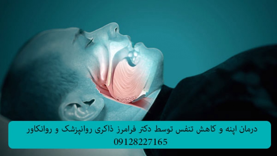 درمان اپنه و کاهش تنفس در خواب