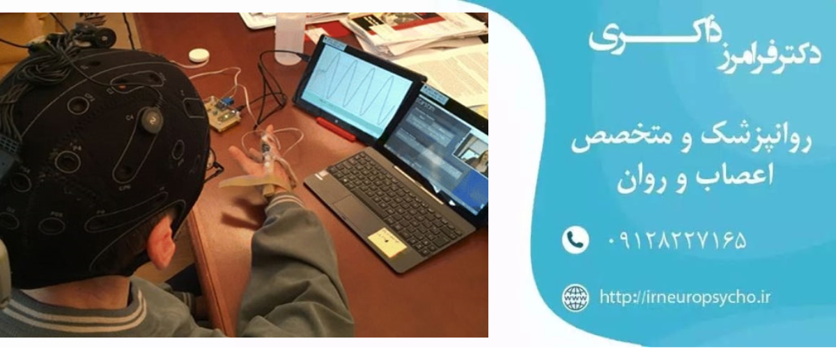 TDCS چیست و برای چه اختلالاتی به کار برده می‌شود؟