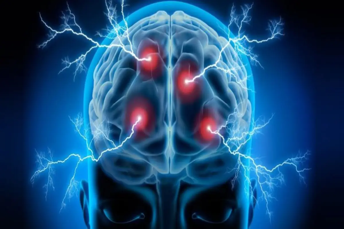 عوارض دستگاه tDCS